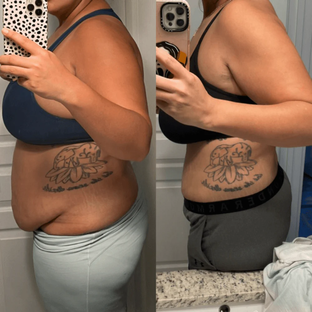 Patches GLP-1 – Le patch qui aligne ton corps avec tes ambitions