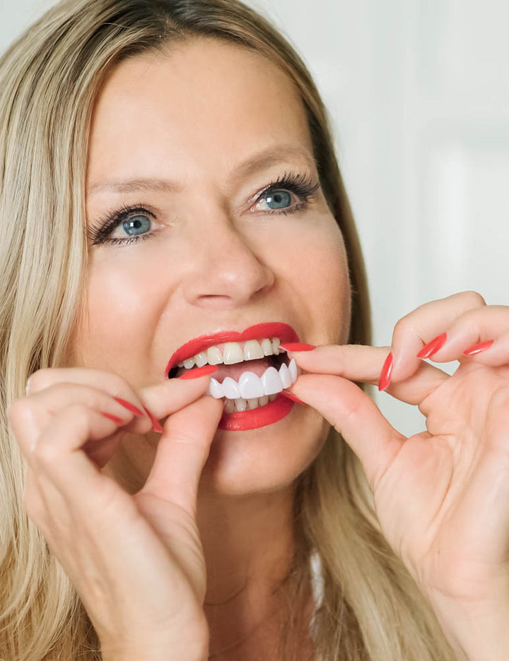 Facette dentaire 3.0