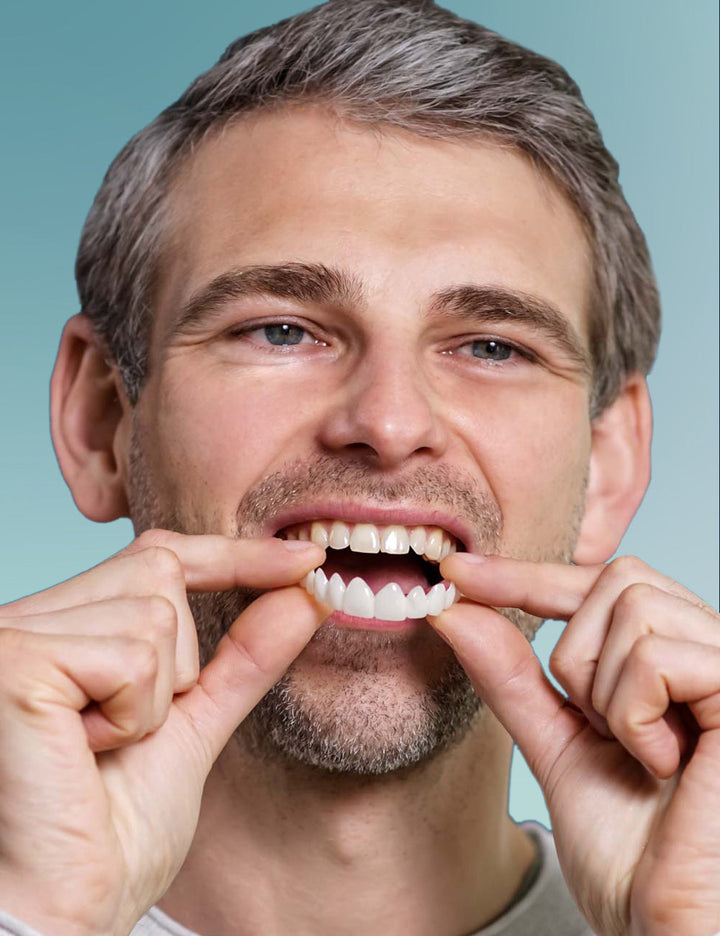 Facette dentaire 3.0