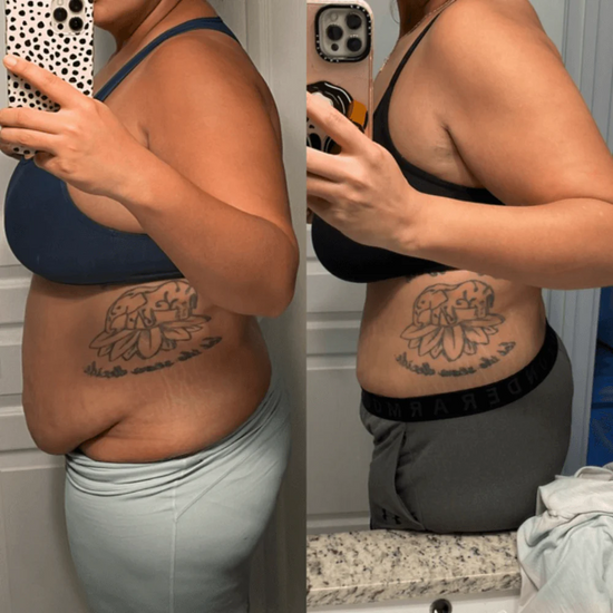 Patches GLP-1  – Le patch qui aligne ton corps avec tes ambitions